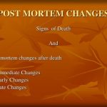 Ppt – Post Mortem Changes Powerpoint Presentation, Free Download – Id:9410019 With Post Mortem Template Powerpoint